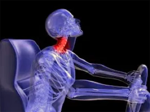 Neck Muscle Analysis of Vehicle Occupants